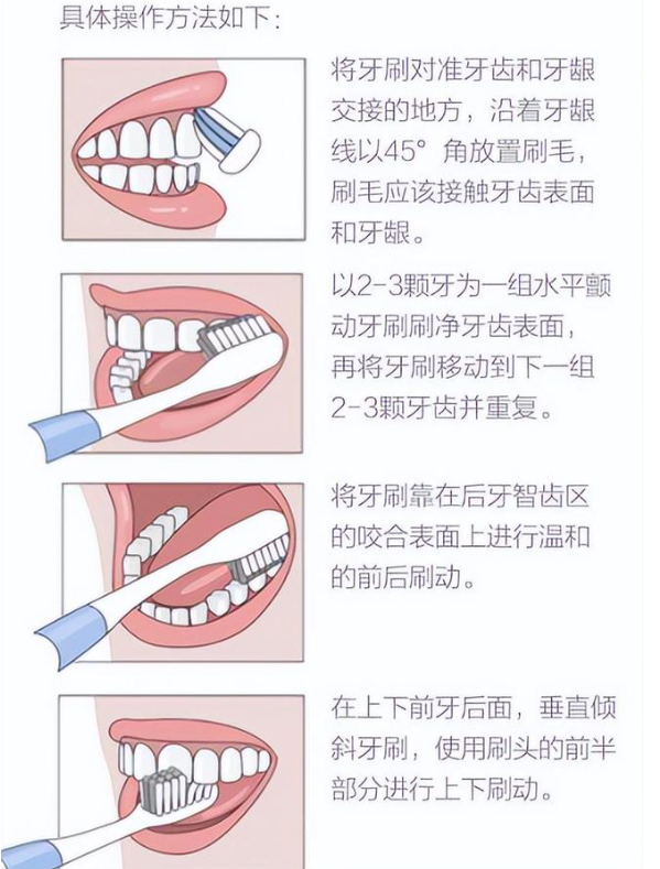 电动牙刷使用方法