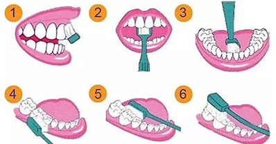 电动牙刷刷牙姿势
